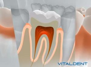 ortodoncia vital dent madrid 
